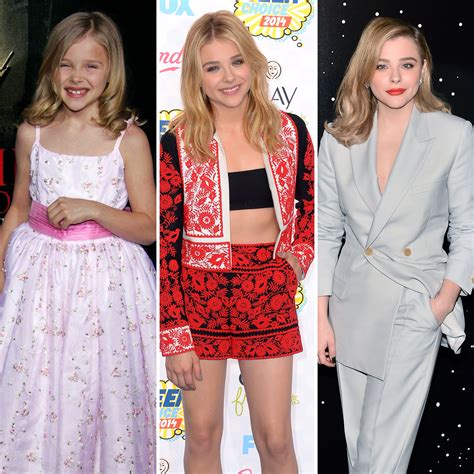 chloe moretz plastic surgery|Chloë Grace Moretz Reveals She Wanted Plastic Surgery At 16.